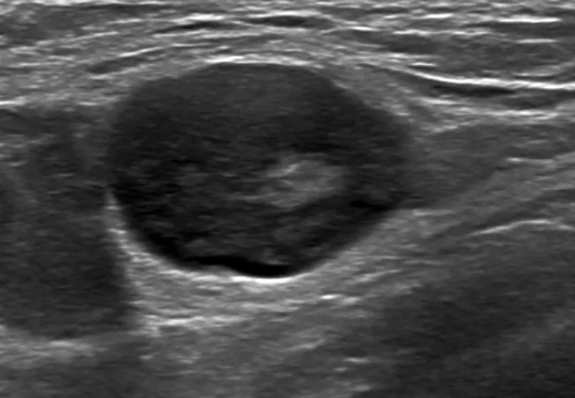 Abnormal Node
