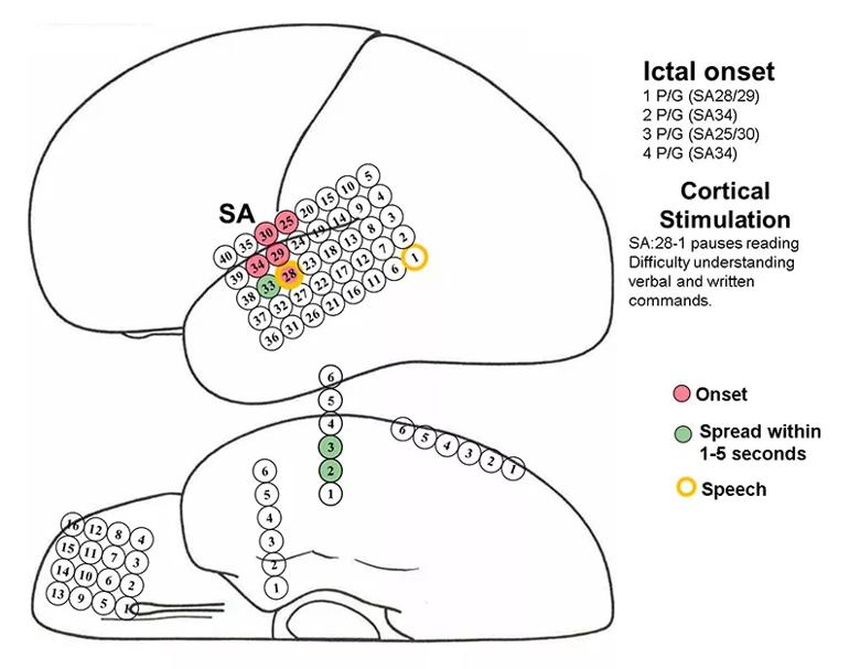 Inset Fig-1