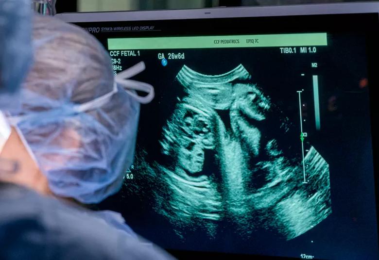 Intraoperative echocardiogram imaging allows the surgical team to track fetal heart function in real time.