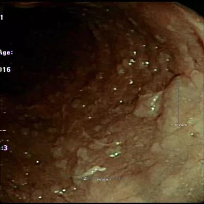 16-ddi-2168-studded-rectum-cqd-inset3