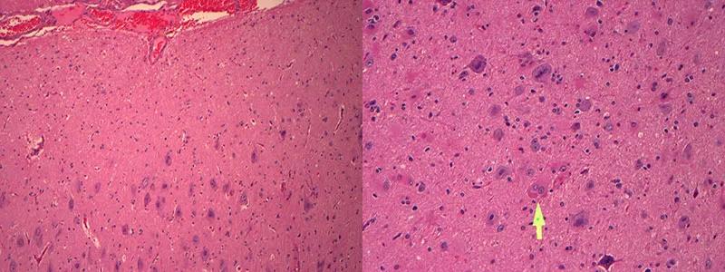 histopathologic view of brain cells