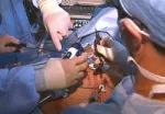 Well-orchestrated teamwork among surgeons is essential to perform this complex surgical procedure.