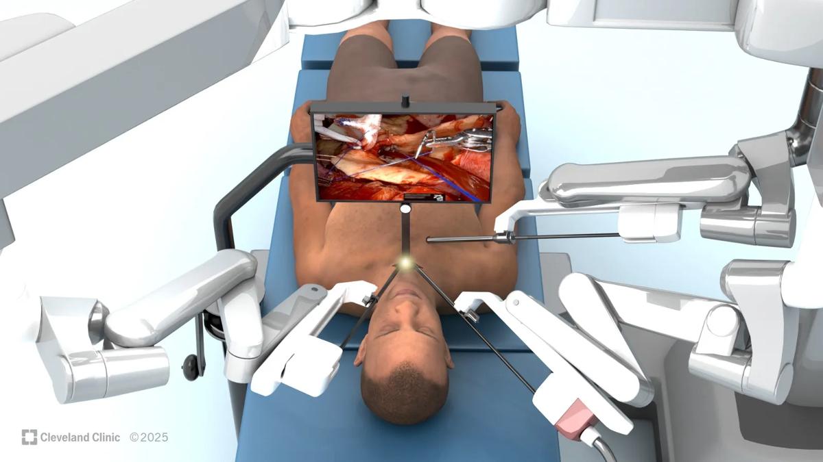 simulated patient undergoing robotic heart surgery on an operating table