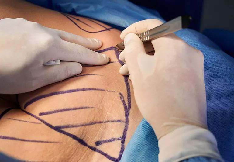 can i take nad+ and tirzepatide together 🚫 Can You Mix NAD+ and Tirzepatide or Semaglutide? Let's Talk Safety! 🚫  We get asked this a lot, so here's the scoop: 👉 NAD+ and Tirzepatide or  Semaglutide should NOT be