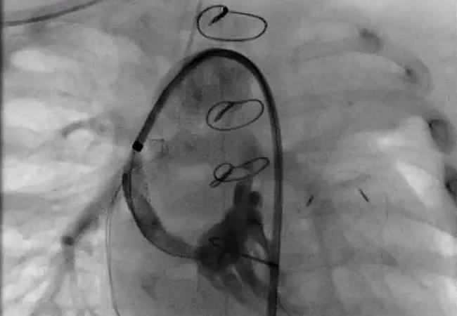 X-ray
