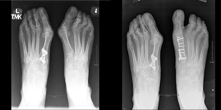 X-rays