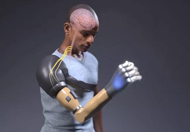 Bionic Arm's Neurorobotic Sensory-Motor Fusion Restores Natural Behaviors