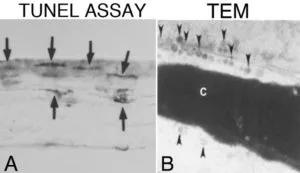 keratocyte apoptosis in response to epithelial injury in the mouse cornea