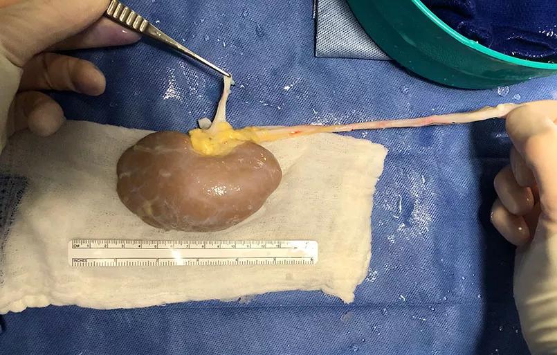 Kidney