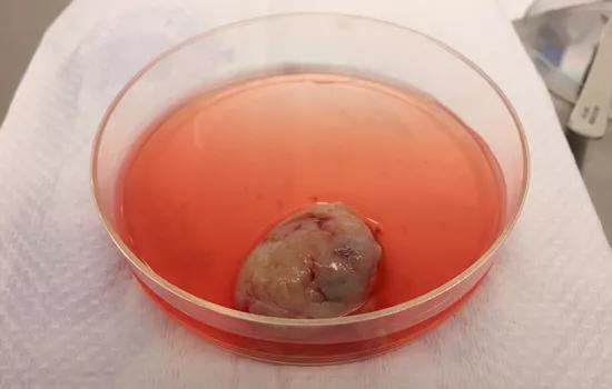 Ovary in culture awaiting dissection.