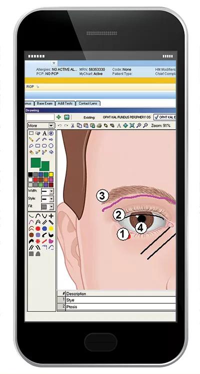 Inset-Phone