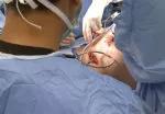 Preparing for graft removal through the Pfannenstiel incision.