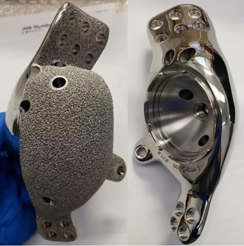 Final manufactured implant