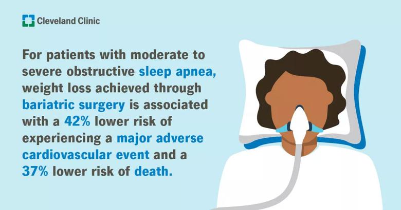 Infographic showing that bariatric surgery reduces health risks related to sleep apnea