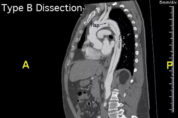 Figure 1. The patient’s CT at presentation.