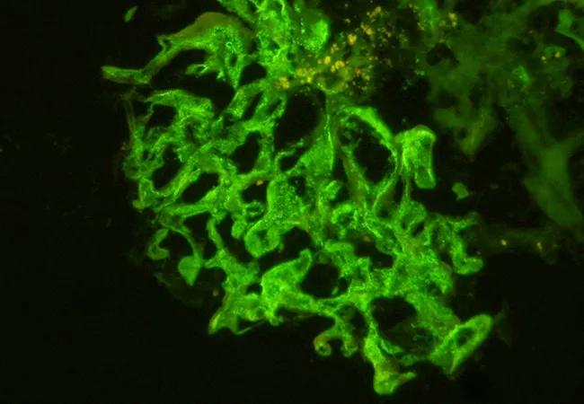 inset-2