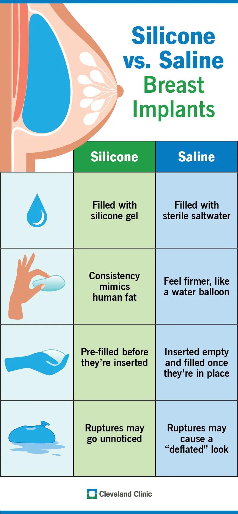 Differences between saline and silicone breast implants