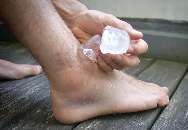 Ice pack or heat pack? What does your injury need? - India Today