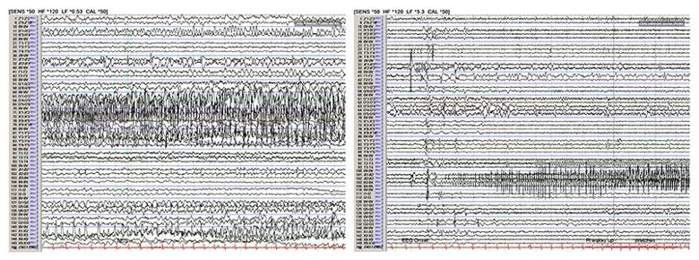 Inset Fig-4a