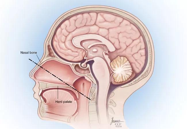 Head diagram