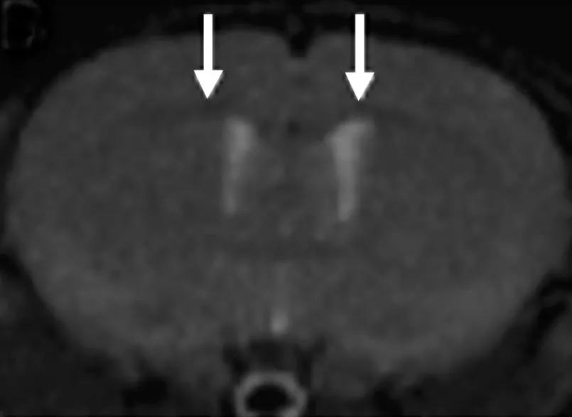 Brain tissue from a murine model was stained with radiolabeled Myelivid and detected using autoradiography