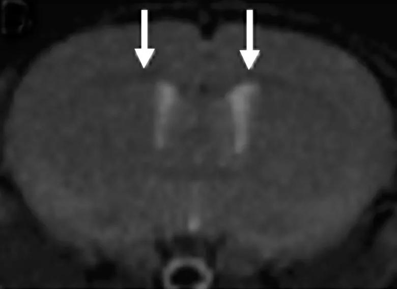 Brain tissue from a murine model was stained with radiolabeled Myelivid and detected using autoradiography
