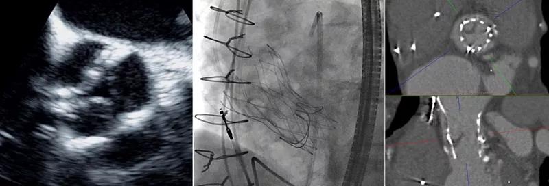 3-panel image from Dr. Schoenhagen