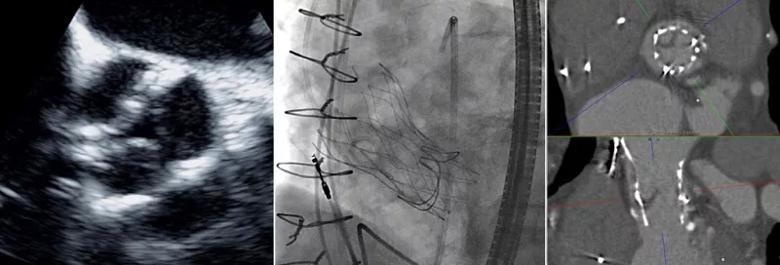 3-panel image from Dr. Schoenhagen