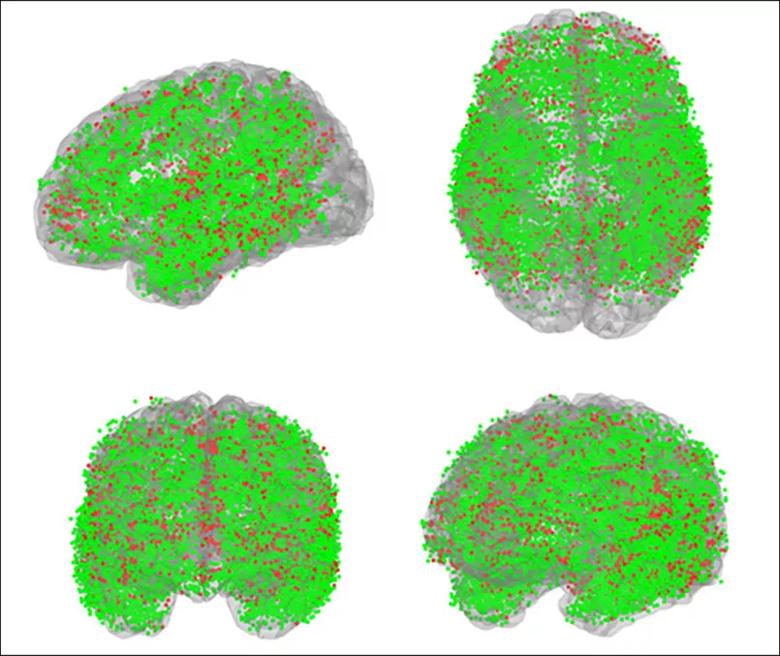brain mapping through labeled SEEG electrodes in epilepsy patients