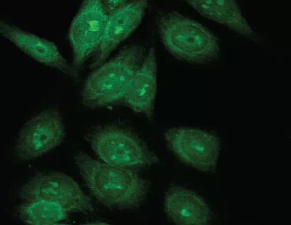 Figure 1. Anti-nuclear antibody indirect immunofluorescence staining showing a nucleolar pattern.