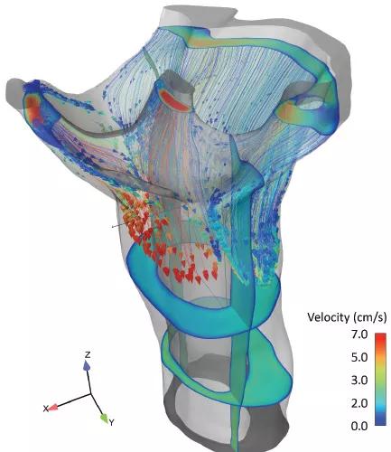 Chiari-fig2b