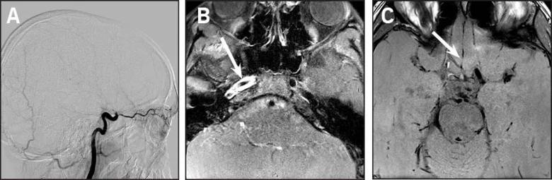 15-NEU-2533-Ruggieri-Fig1