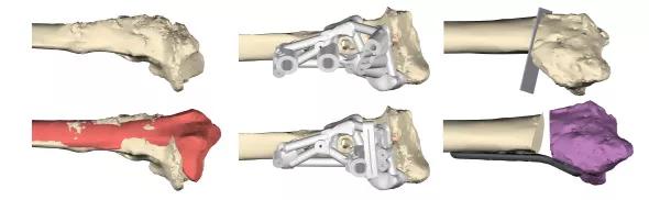 3D-Templating_Fig-1_Seitz_590pxl-width