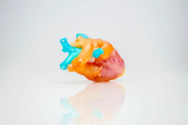 Photograph of 3D-printed model of patient's heart