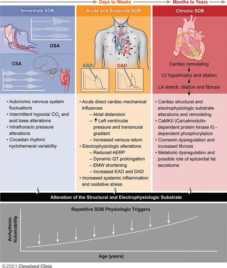Chart showing SDB pathophysiology contributing to cardiac arrhythmogenesis