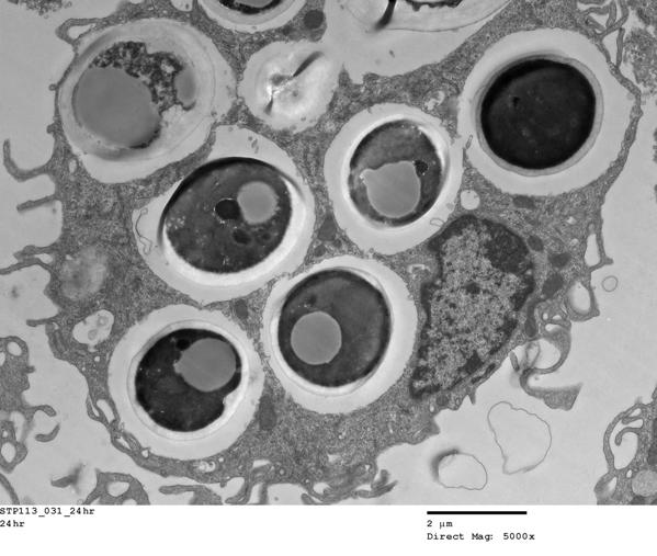 infected macrophage