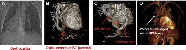 Preoperative patient imaging 