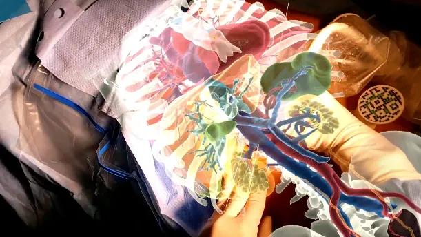 3D imaging scan of a patients' anatomy.