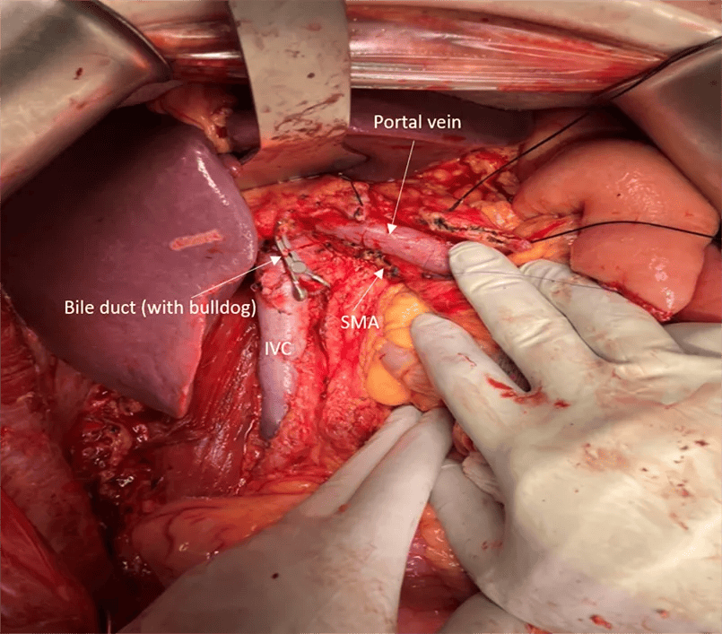 Surgery