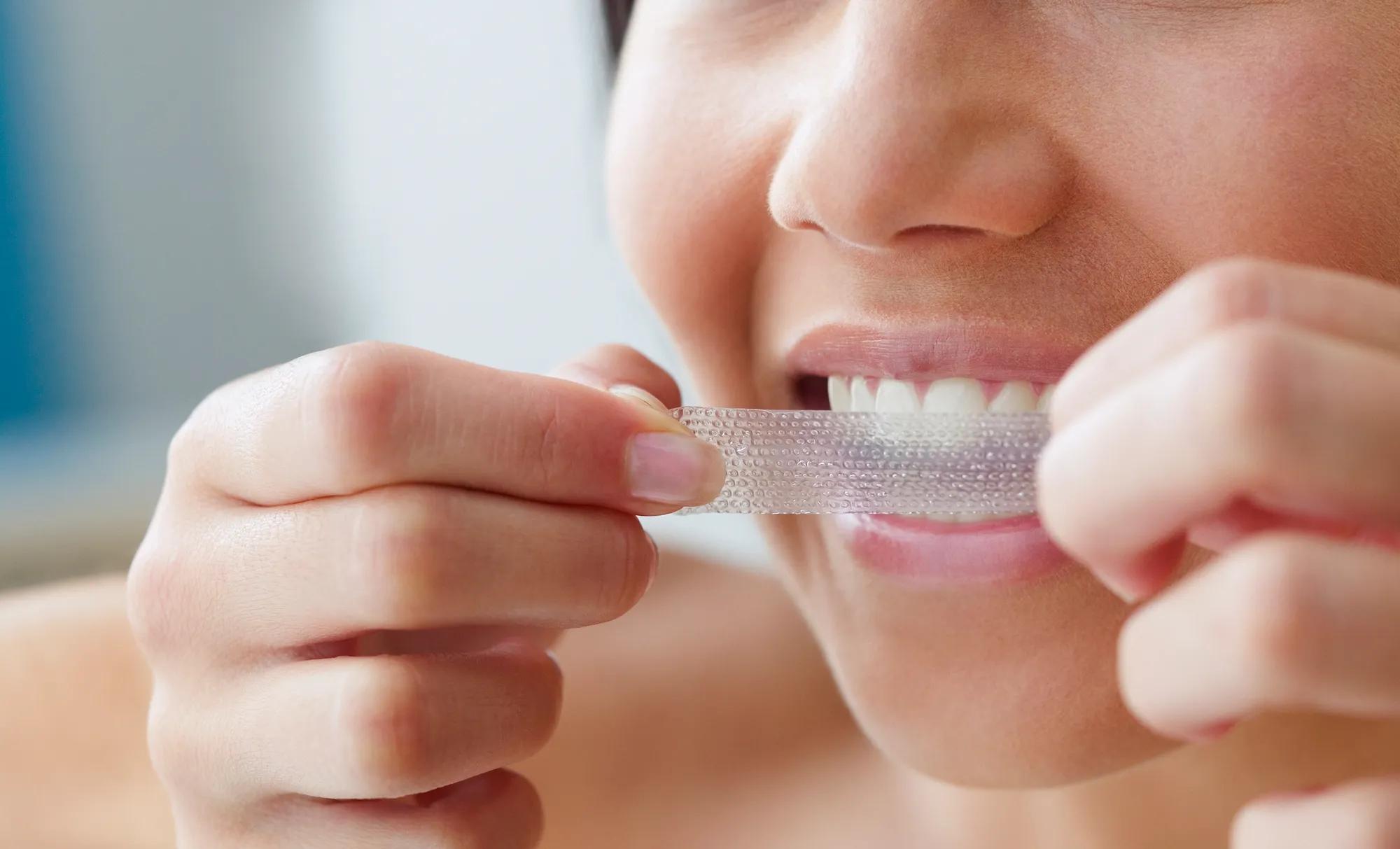 Professional teeth whitening treatment at dental clinic