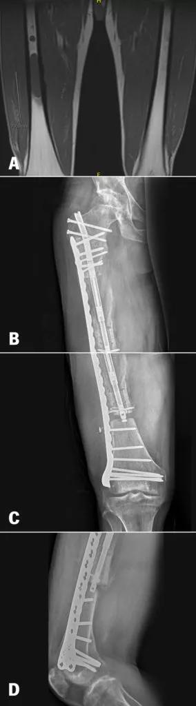 X-rays