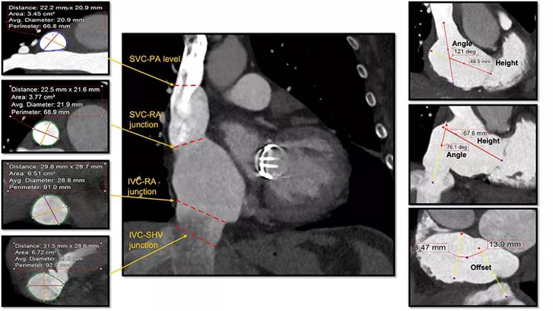 imaging studies of the human heart