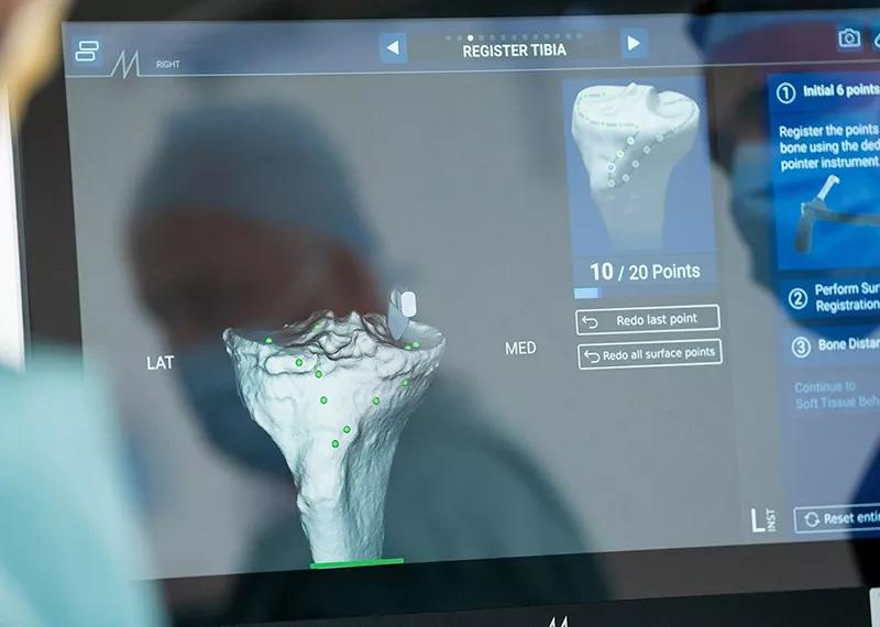 Virtual model planning the size and position of knee implant