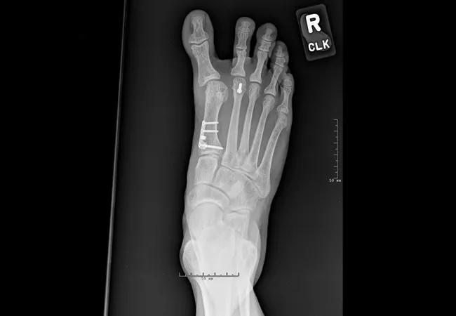 X-ray