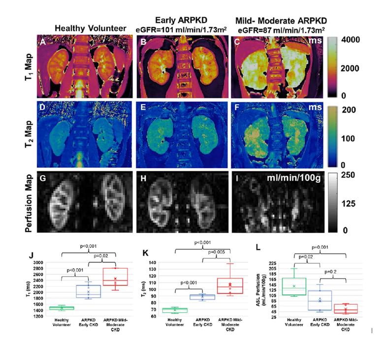 Multimodal imaging in patients with ARPKD and healthy volunteers