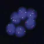 C13-6534-ALK-Target-21-inset