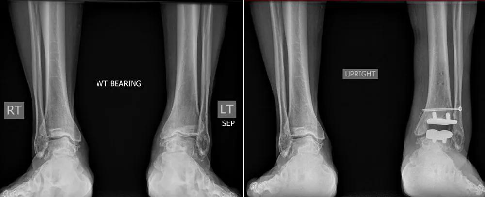 X-ray scans of the ankle.
