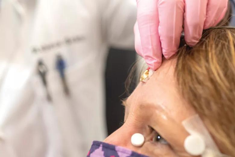Sensors attached to a patient's nose and forehead