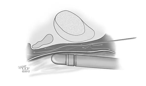 Figure-1b
