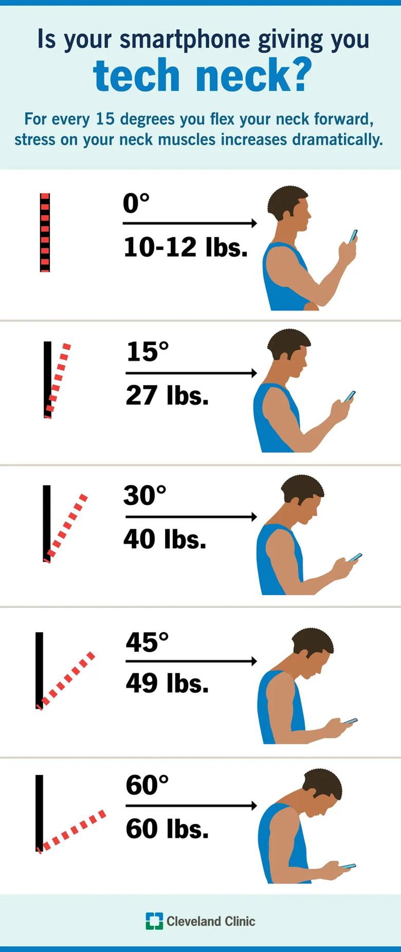 The physical impact of tech neck